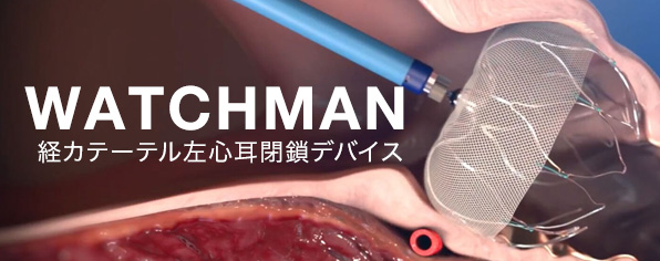 WATCHMANの導入