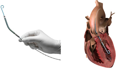 Impella(インペラ)の治療開始