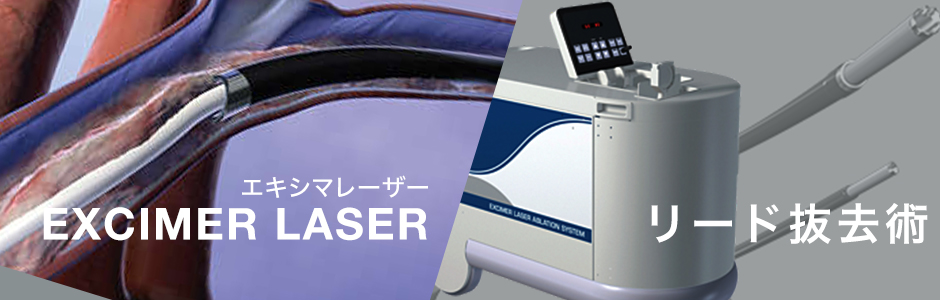 エキシマーレーザーを使用した心臓植込み装置(デバイス)のリード抜去